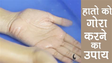 Fair Hands Home Remedies - In a Week (Hindi) - YouTube