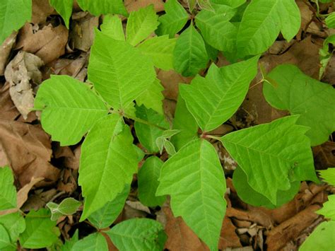 How To Get Rid Of Poison Ivy As Fast As Possible: 7 Tips From Someone Who's Been There