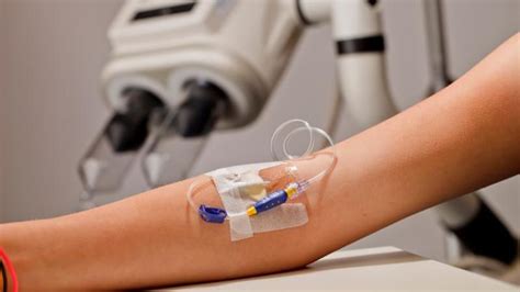 Vascular Access Devices Market Report | Global Forecast From 2023 To ...