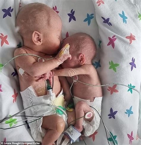 Premature twins separated at birth 'cuddle and hold hands'