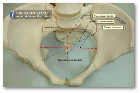 The True conjugate diameter of the pelvis is about 1.5 cm