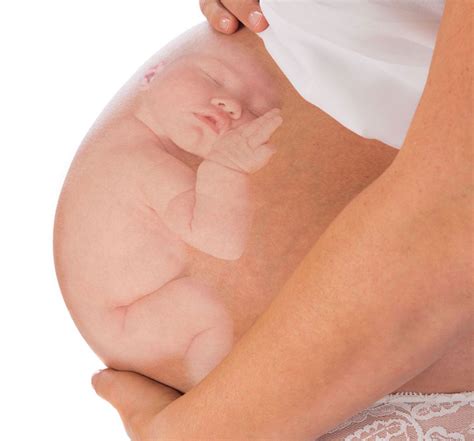 If Your Baby is Breech | Birth International