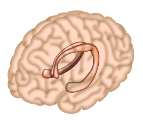 How the hippocampus distinguishes true and false memories