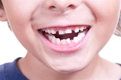 Things About Your Growing Child’s Mouth - McDonald Orthodontics