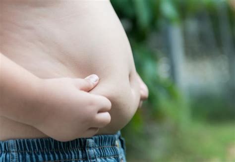 Emerson Villela Carvalho Jr., M.D.: Many parents may not recognize child obesity