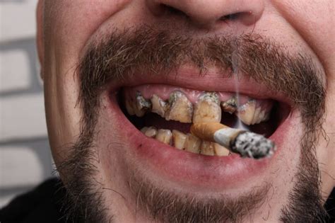 What Tobacco Does to Your Oral Health | Birch Point Dental Clinic | Thunder Bay, ON