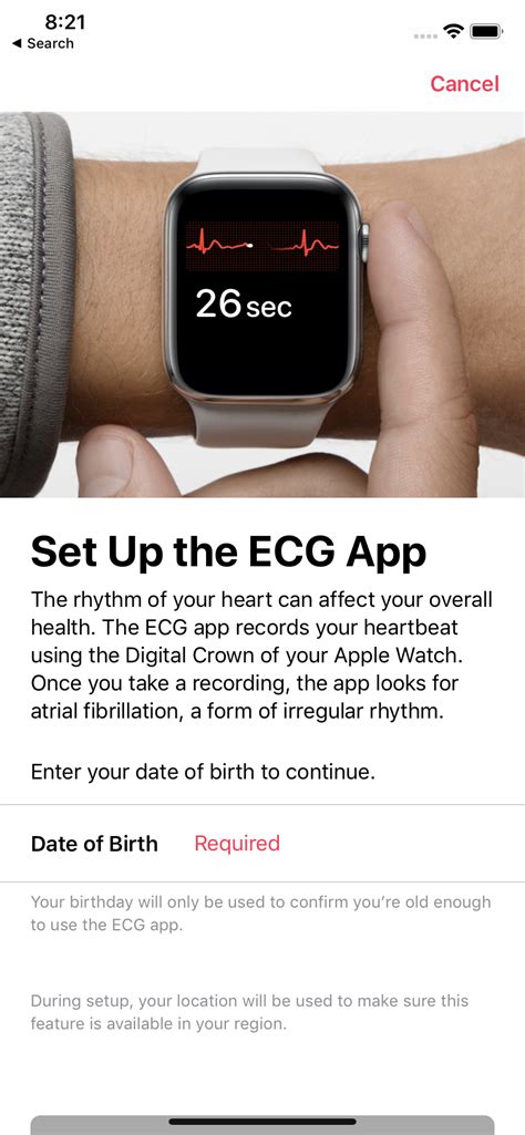 ECG is now available on the Apple Watch in SG and here’s what you need to know - HardwareZone.com.sg