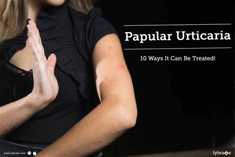 Papular Urticaria - 10 Ways It Can Be Treated! - By Dr. Sonal Chavan ...