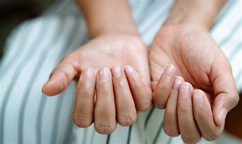 Common Hand Infections in Primary Care - SingHealth