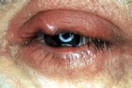 Oculoplastics | Lee Eye Center