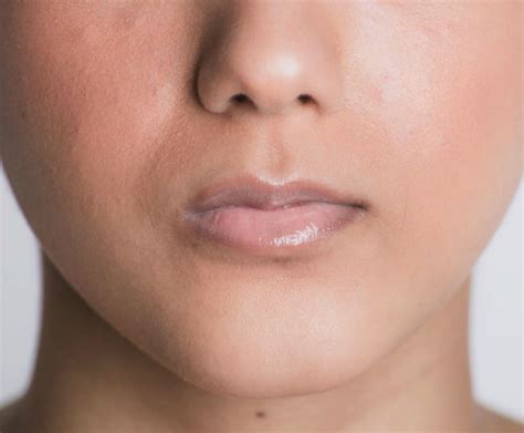 The Best Treatments for Lip Lines and Lip Wrinkles