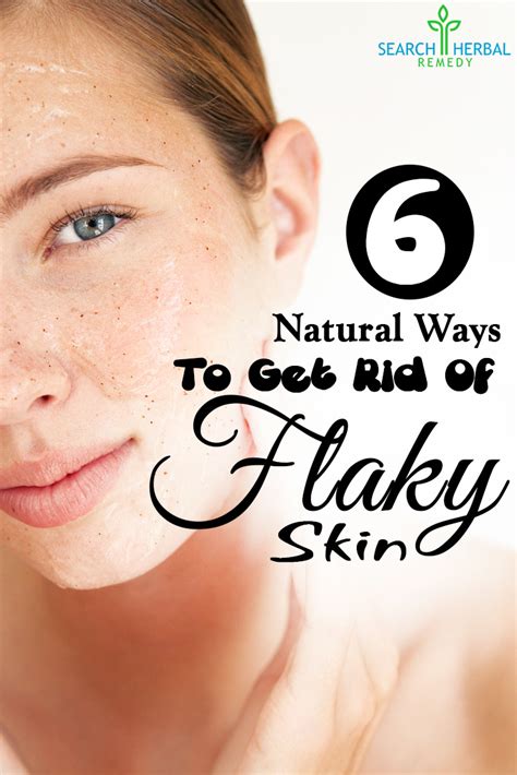 6 Easy Natural Ways To Get Rid Of Flaky Skin | Search Herbal & Home Remedy