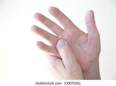 Scars On Hands Picture Scar Caused Stock Photo (Edit Now) 1785097634