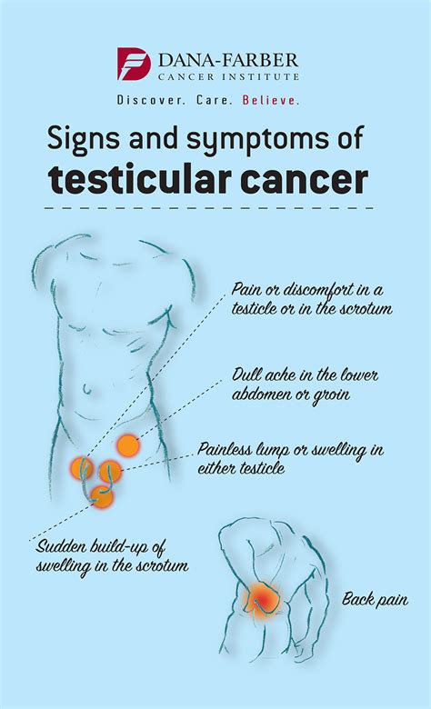 Treatment of Testicular Cancer in Young Men | Dana-Farber Cancer Institute