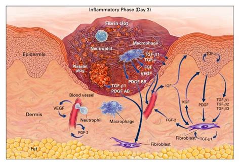 Cutaneous Wound Healing | NEJM