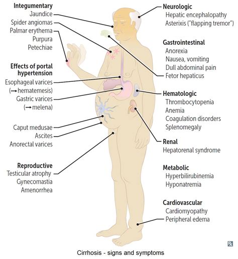 Liver Disease & Diet for Health