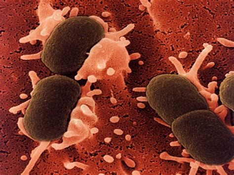 E. Coli (Escherichia Coli) Infection Causes, Symptoms, Diagnosis ...