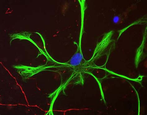 Anti-Glial Fibrillary Acidic Protein (GFAP) Antibody | AB5804