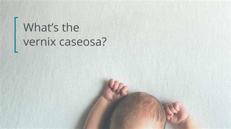 Vernix Caseosa: Benefits for Baby