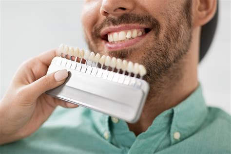 The Pros and Cons of Dental Veneers - Lee Trevino Dental