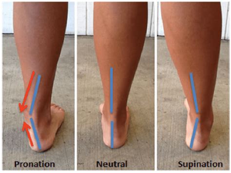 ★Supination and Pronation of the Foot? - Riktr PRO Deep Tissue - Sports Injuries, Nicola, LMT