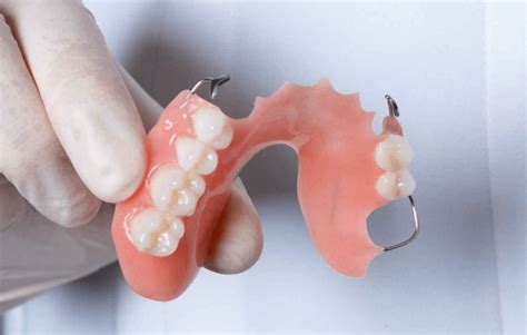 Acrylic Partial Denture - Atlas Dental Toronto