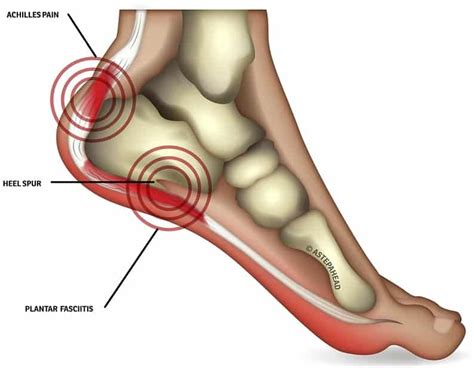 Spiritual Meaning of Foot Pain (Knees, Heels, Ankles) and Healing ...