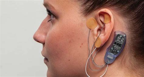 Neurostimulator Devices Is A Breakthrough in Treating Neurological Disorders – Macmillan ...