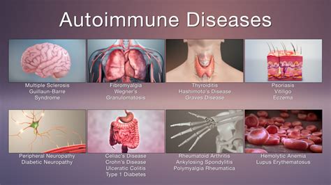 Hashimoto's Autoimmune Thyroid-Patients with Normal TSH Values- | Dr. Hagmeyer