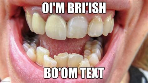 Image tagged in funny,memes,funny memes,british,teeth - Imgflip