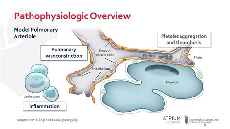 Pathophysiology of Pulmonary Arterial Hypertension - YouTube