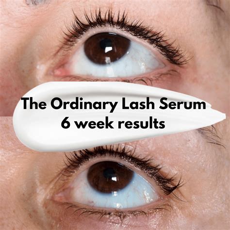 Does The Ordinary Multi-Peptide Lash and Brow Serum Work?