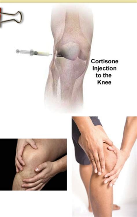 Today's procedure.. Knee injection.. Cortisone injection for a patient ...