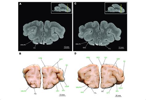 | MRI imaging and cross sections through the anterior part of... | Download Scientific Diagram