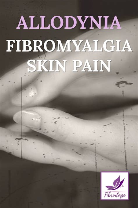 Allodynia: Fibromyalgia Skin Pain