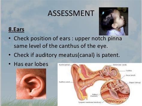 Assessment newborn