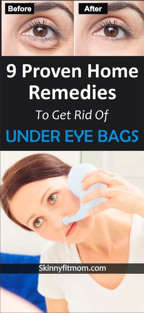 Learn how to get rid of under eye bag. These 9 home remedies are tested ...