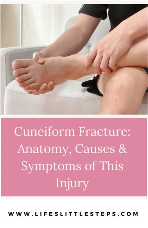 Cuneiform Fracture: Anatomy, Causes & Symptoms of This Injury