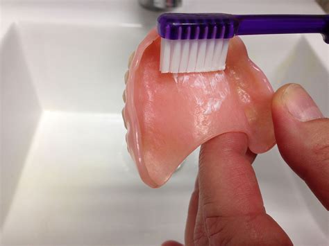 How To Clean Dirty Dentures at Jason Kim blog