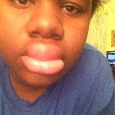 Kylie Jenner Challenge Lips - Famous Person