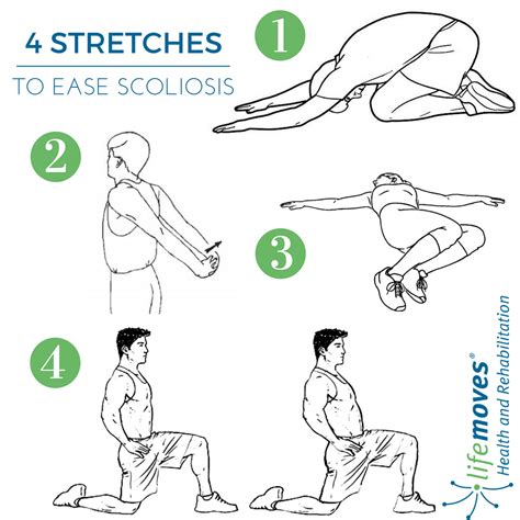 Image result for scoliosis | Scoliosis, Yoga for scoliosis, Scoliosis exercises