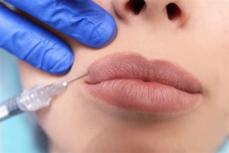 How to Get Plump Lips without Fillers - itsmeandyou.com