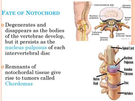 EXAMS AND ME : Notochord