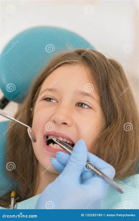 Macro Close Up of Young Child with Open Mouth at Dentist. Teeth Checkup at Dentist& X27;s Office ...