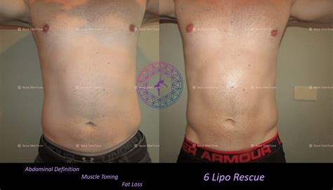 Intensive Lipo Rescue - Slim Tone