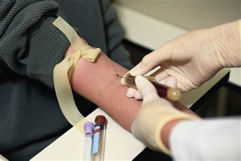 Blood Draw Procedure and Techniques - E Phlebotomy Training