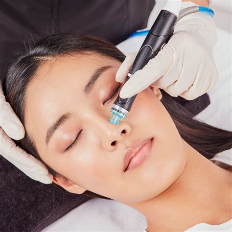 Hydrafacial for amazing skin!