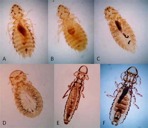 Can Chicken Lice Transfer To Humans?