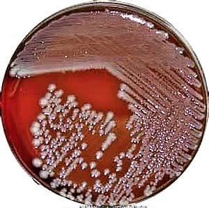 選択した画像 e.coli morphology on agar plate 133866-How to identify e coli on agar