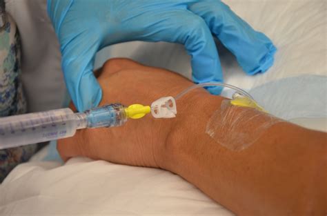 Injecting Saline Into Your Sac